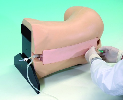 01-epidural-03