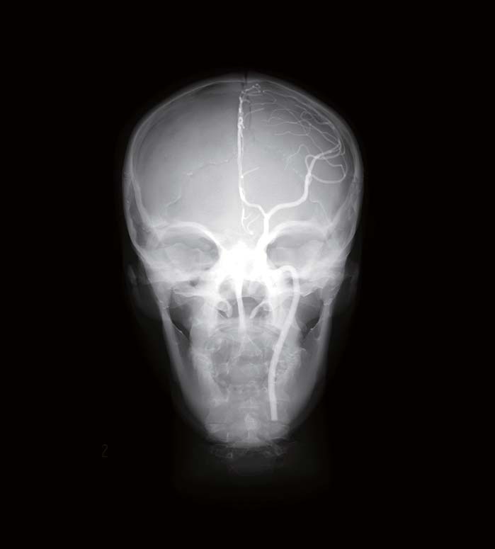06-pbu60-x01