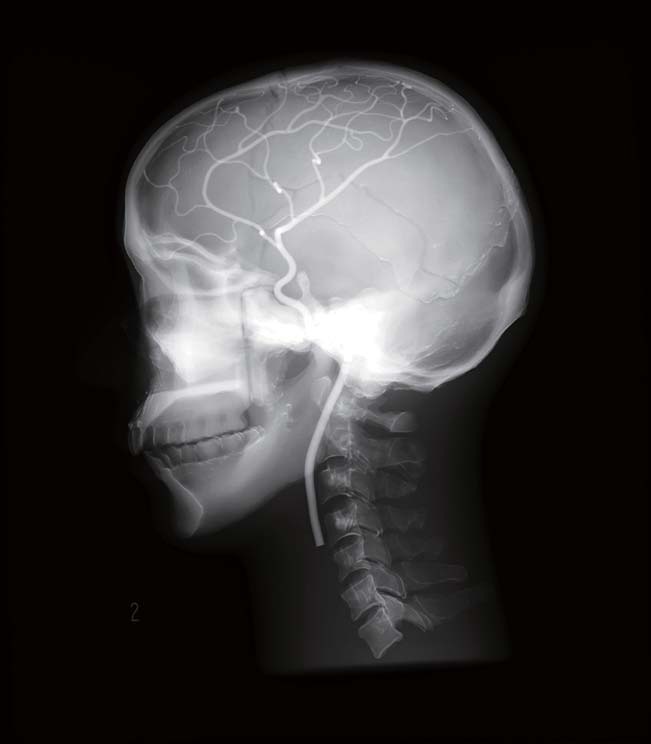 06-pbu60-x02