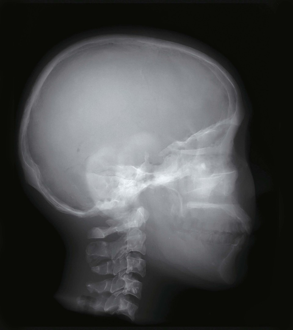 08-pbu-50-x02