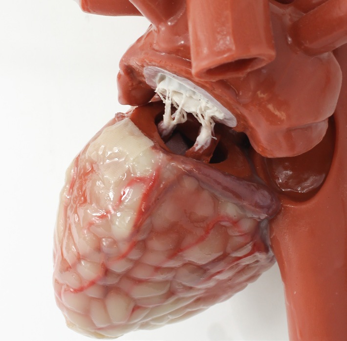 1376-mics-thorax-b-np-180329