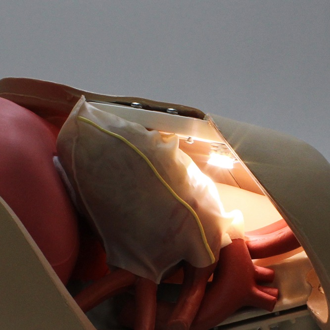 32010-c-mics-thorax-internal-lighting-20151204-0039
