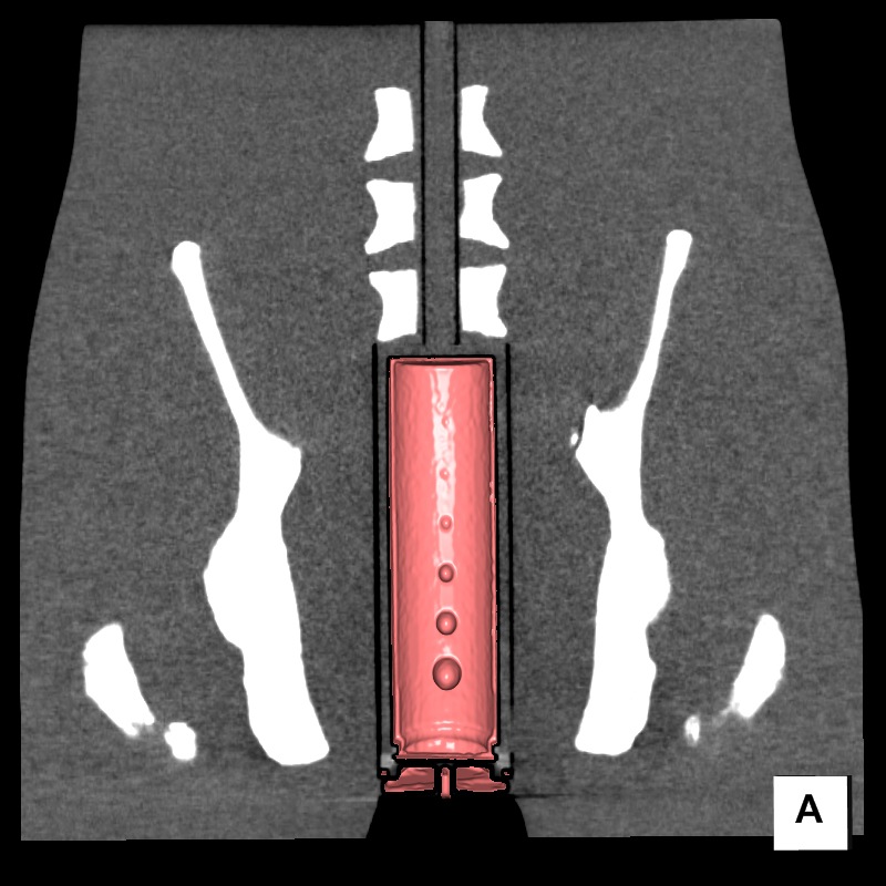 asection