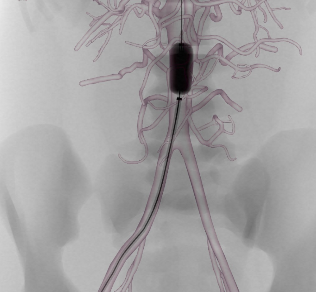 case1-trauma