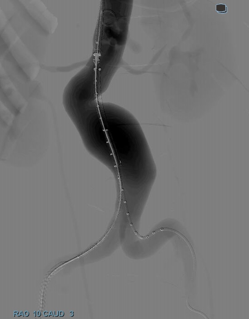 evar2-cropped