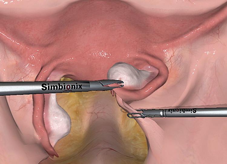gynecology