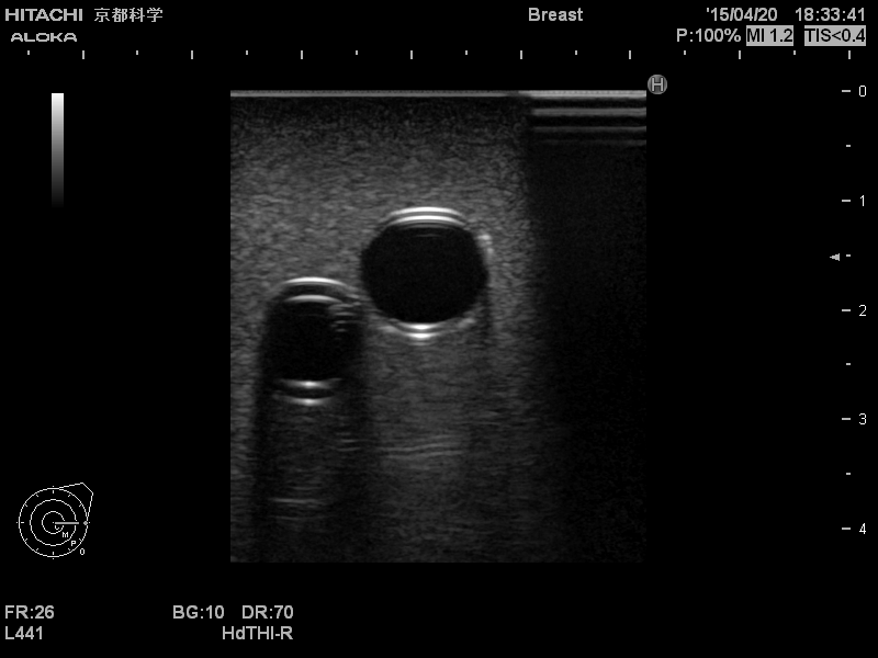 internal-jugular-vein