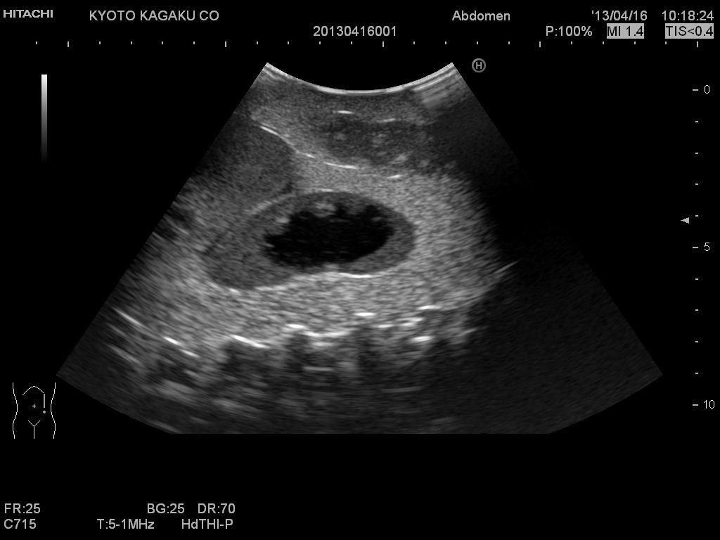left-kidneys