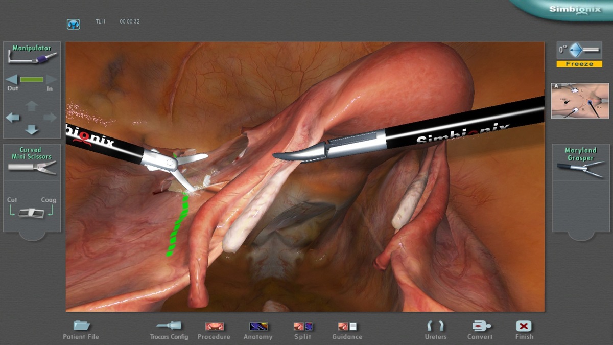 opening-the-peritoneum