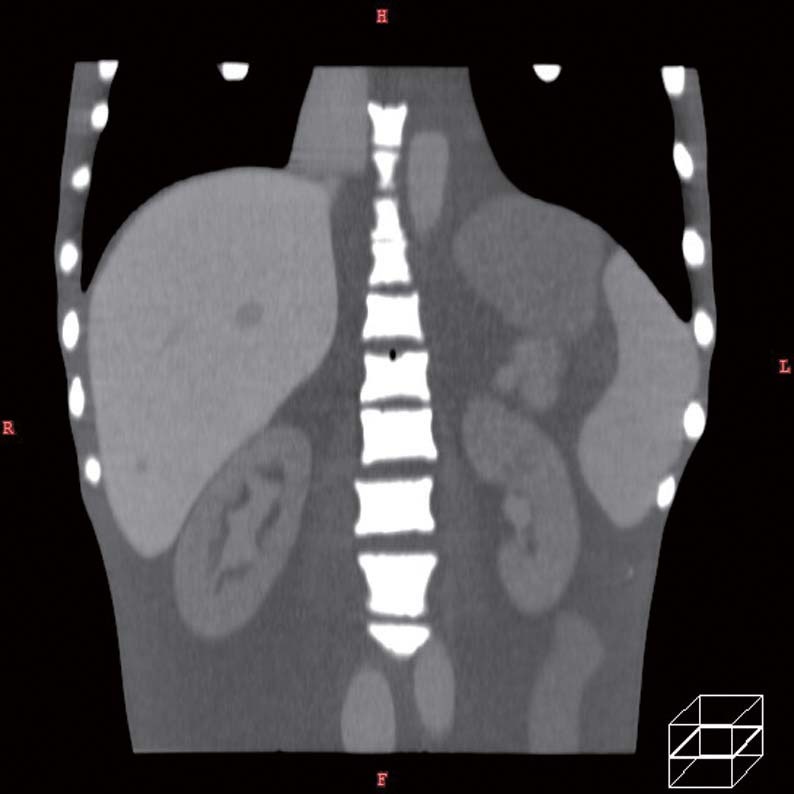 ph-5abdomen-cor