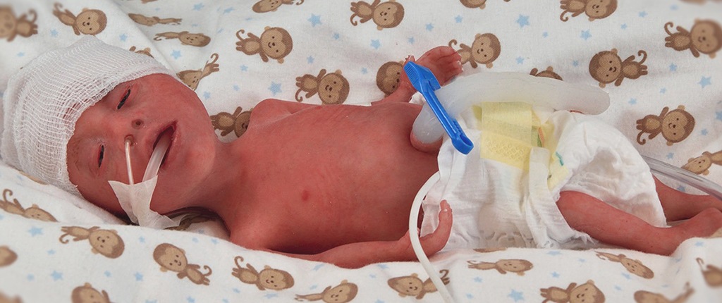 product-nena-sim-preemie-billboard-mini