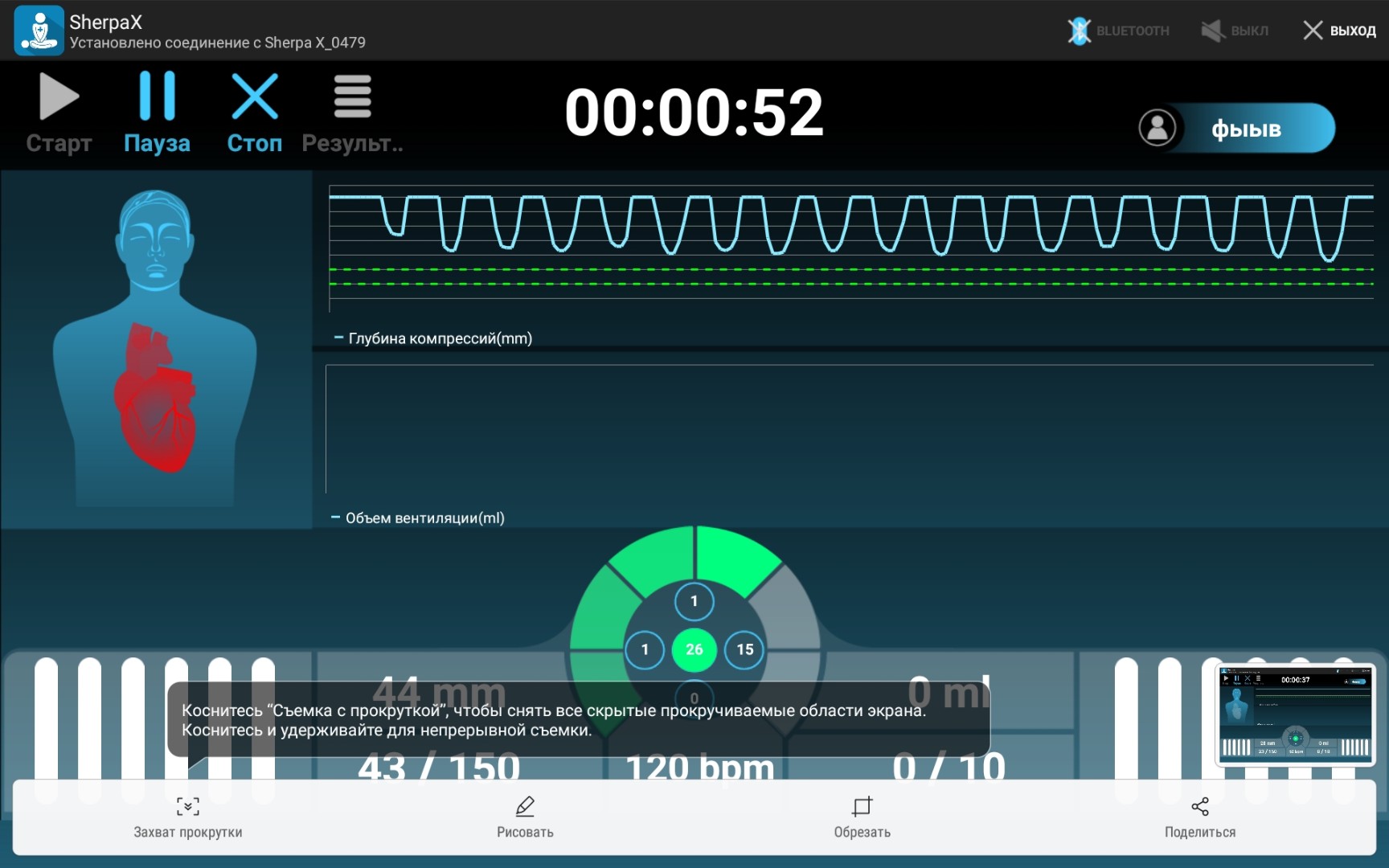screenshot-20190410-152716-sherpax1