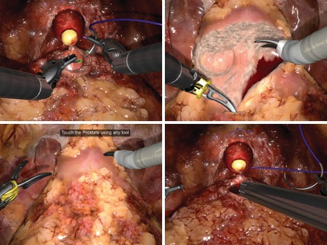 urology-course