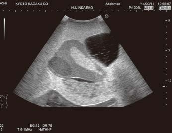 us-10-female-pelvic-20150730-3