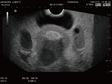 us-10-female-pelvic-20150730-4