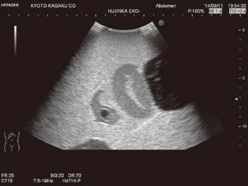 us-10-female-pelvic-20150730-5