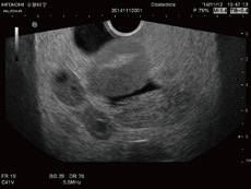 us-10-female-pelvic-20150730-6