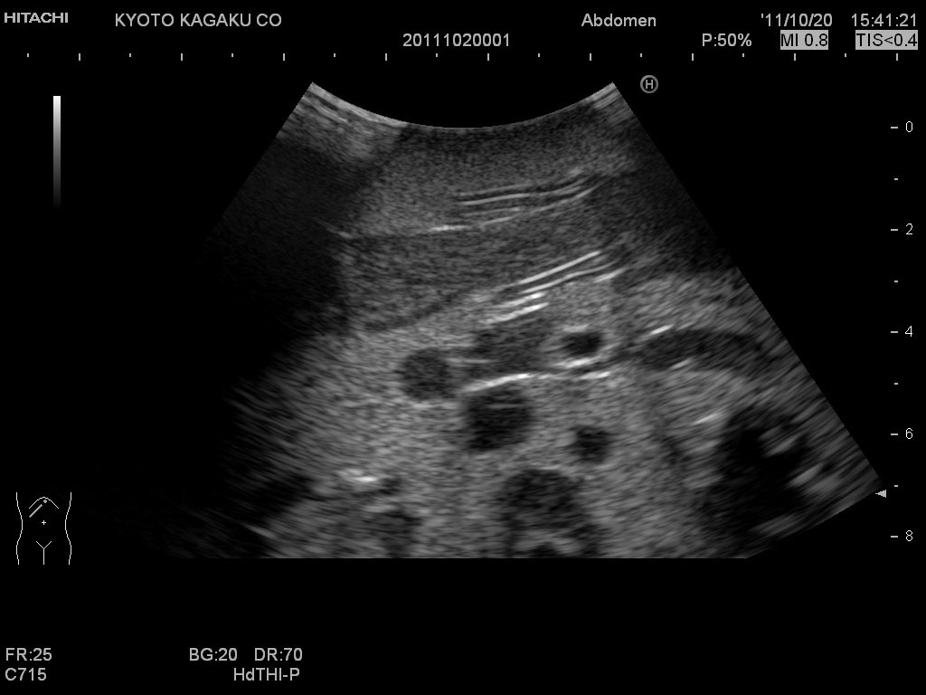 us8-image-2