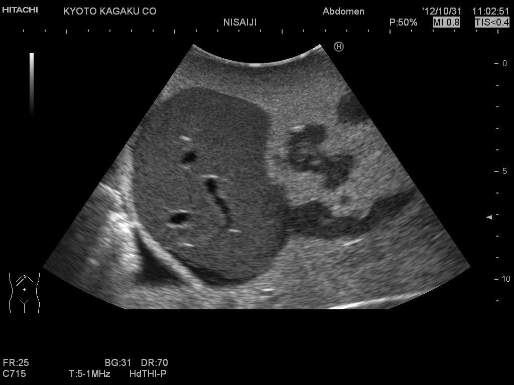 us8-image-3