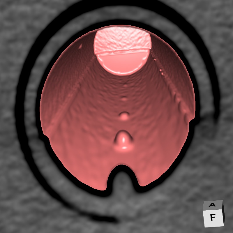 vc-projection-r