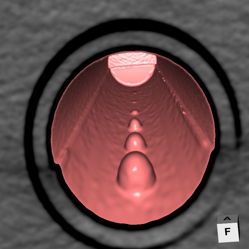 vc-projection